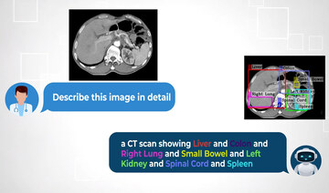 How a cutting-edge AI model developed in Saudi Arabia is reshaping medical diagnostics